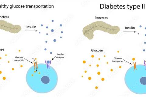 Diabetes Treatment Algorithm For Patients Who Are On Medication