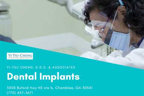 What Are Full Mouth Dental Implants And What Do They Cost?
