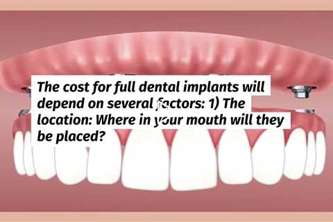 What Are Full Mouth Dental Implants And What Do They Cost  - chengdds.com