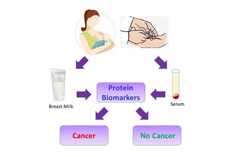 Scientists Identify Cancer Biomarkers In Breast Milk