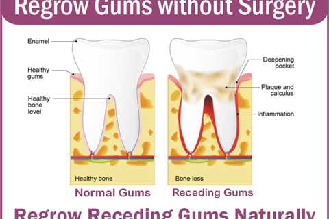 Natural Gum Regrowth Products And Cure - WS Magazine