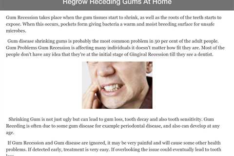 Remedies To Regrow Receding Gums