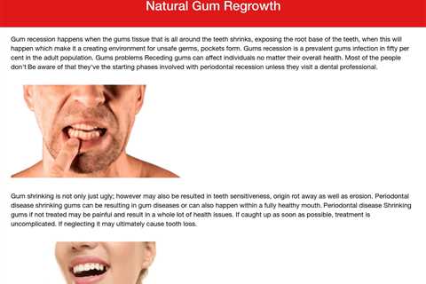 Secret Home Remedies To Stimulate Gum Regrowth Naturally