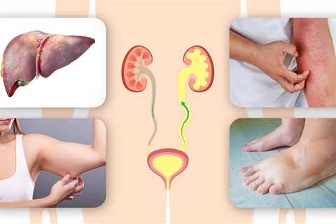 The Dangers of Urinary Retention on Your Kidneys