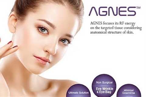 AGNES - revolutionary RF treatment for eyebags and acne