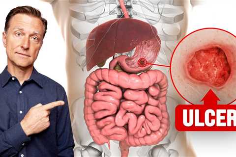 The FASTEST Way to Heal an Ulcer