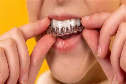 Do dentists make money with invisalign?