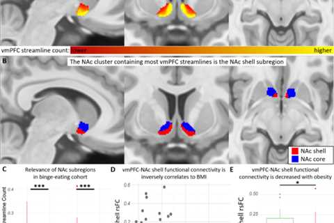 Aberrant impulse control circuitry in obesity