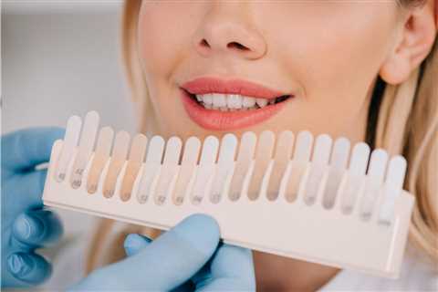 Professional Teeth Whitening in Beverly Hills and Los Angeles, CA