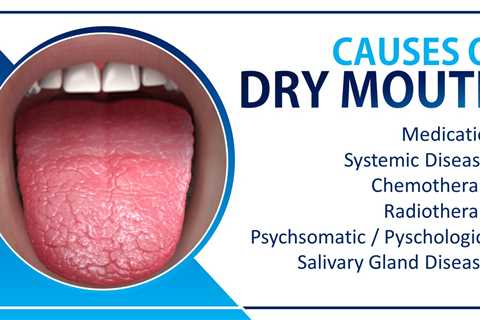 treat dry mouth naturally