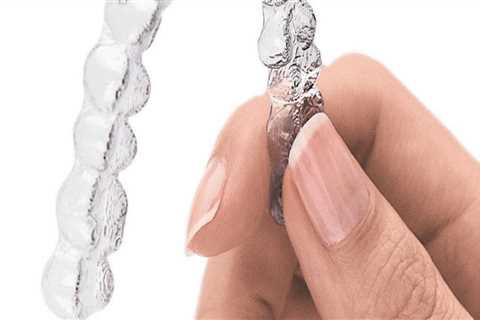 Are invisalign printed in 3d?