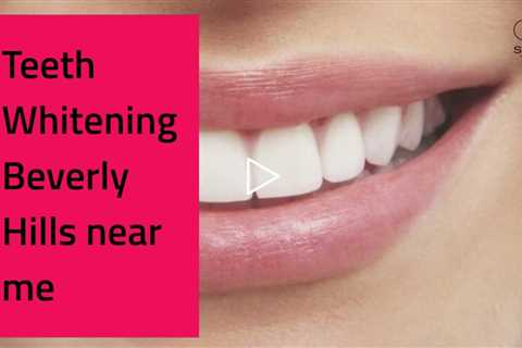Teeth Whitening in Beverly Hills by Song Cosmetic Dentistry (310) 551-2955