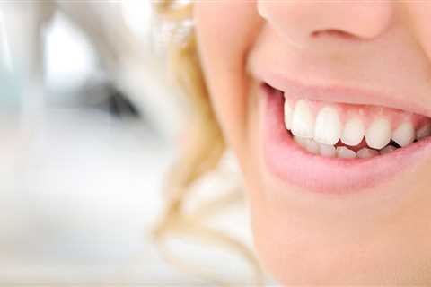 Can Gums Grow Back After Receding? - Diet Food Meals