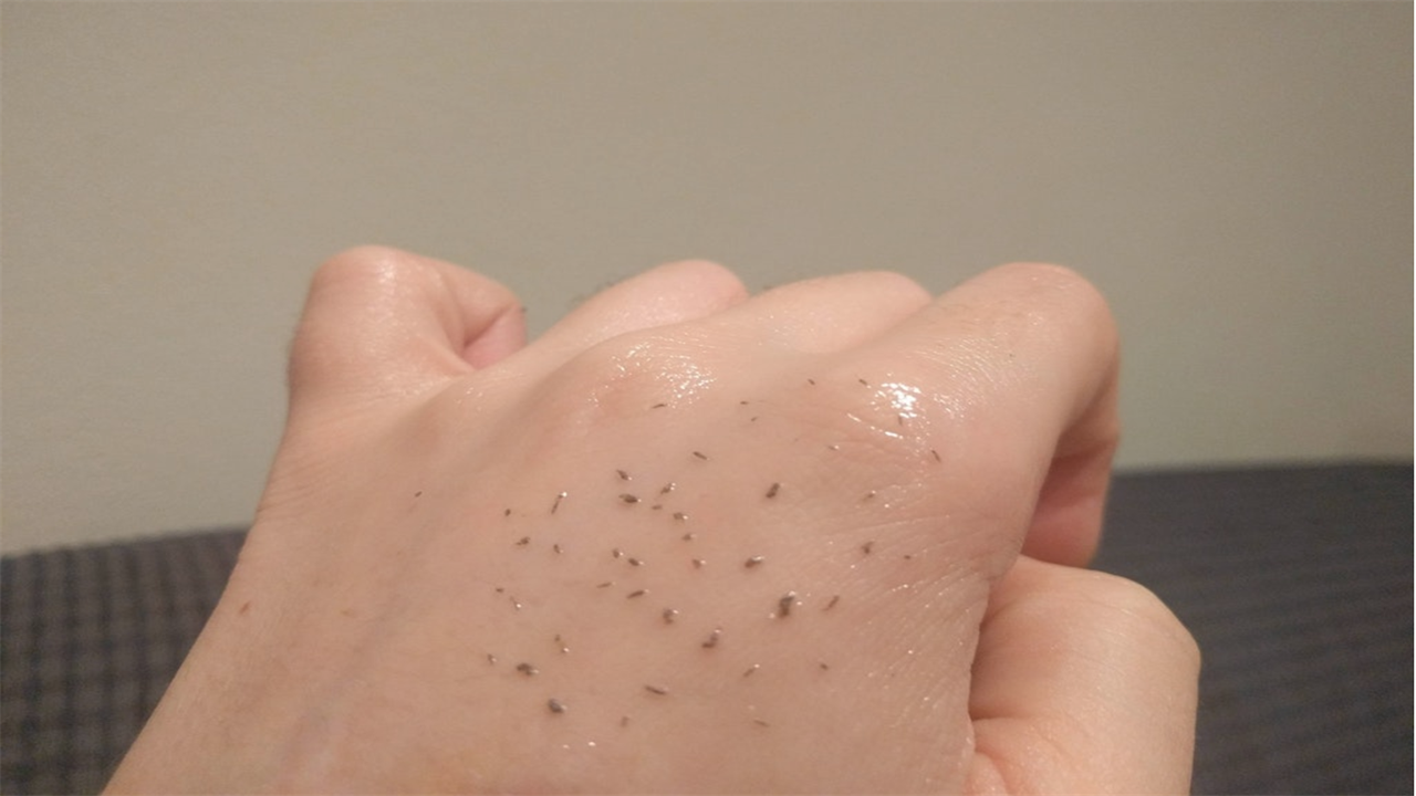 This Weird Blackhead Removal Trick Is Every Pimple-Popper's Dream