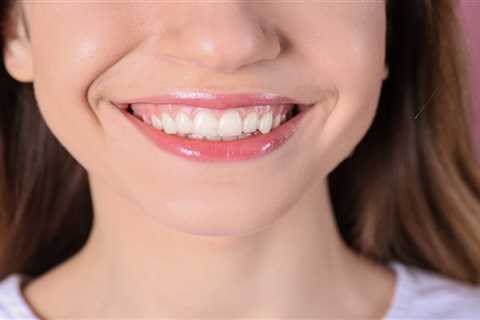 How To Regrow Receding Gums Naturally? - Happy, Healthy, Fit and Fine