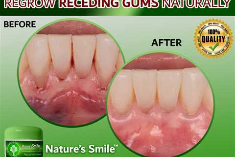 Natures Smile Sale