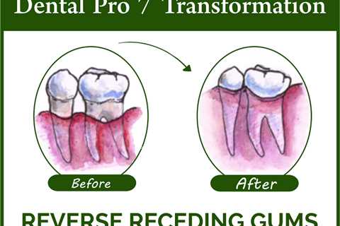 Dental Pro 7 and Gum Recession