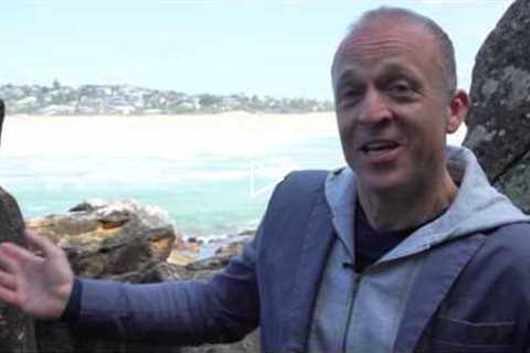 Hair Transplant Sydney | Paul's Progess 12 Weeks Time-Lapse