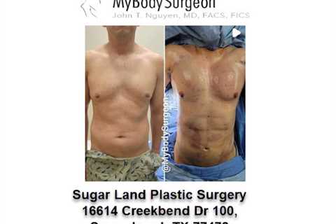Sugar Land Plastic Surgery
