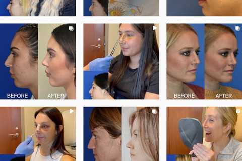 The Seattle Facial Plastic Surgery Center