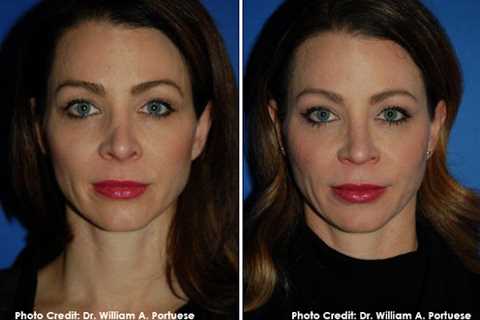 The Seattle Facial Plastic Surgery Center