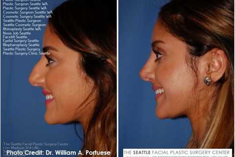 facial plastic surgeon near me | Plastic surgeon, Facial plastic, Nose surgery