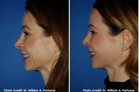 The Portland Center for Facial Plastic Surgery