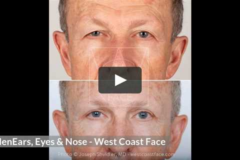 Men Ears, Eyes & Nose in Seattle Washington