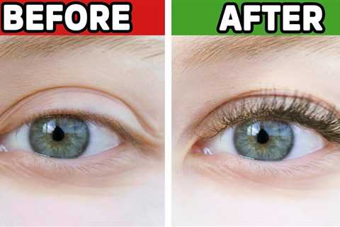 #1 Best Remedy for Eyelashes that are Falling Out