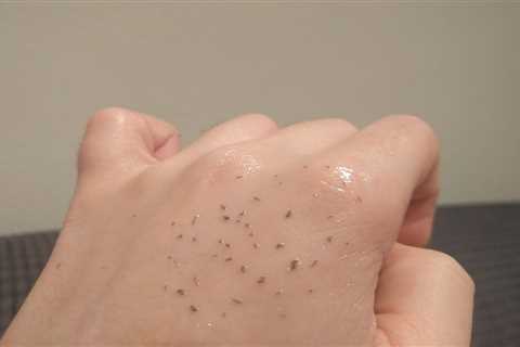 This Weird Blackhead Removal Trick Is Every Pimple-Popper's Dream