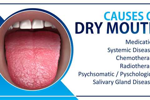 cure dry mouth after drinking