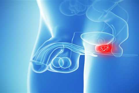 What is prostate cancer? Signs and symptoms of the condition