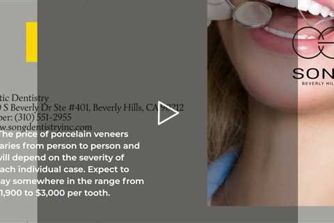 Song Cosmetic Dentistry Porcelain Veneers Beverly Hills:  #veneers_smile #dentist #dentistry