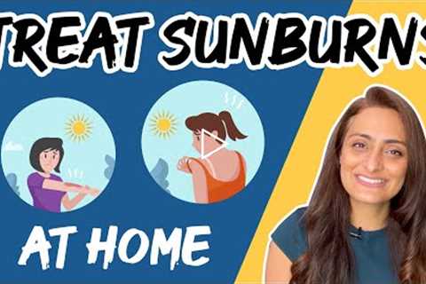 Natural Treatment for Sunburns at Home |  Sunburn Causes & Treatment | Dr. Aanchal