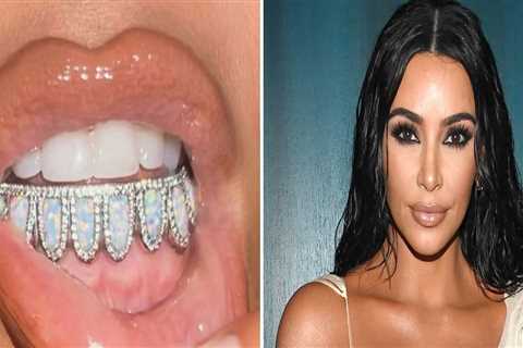 What has kim kardashian done to her teeth?