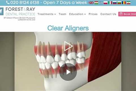 Clear Aligners London - Forest & Ray - Dentists, Orthodontists, Implant Surgeons
