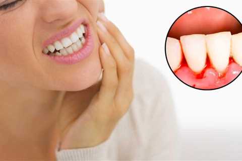 Home | Remedies For Growing Back Receding Gums