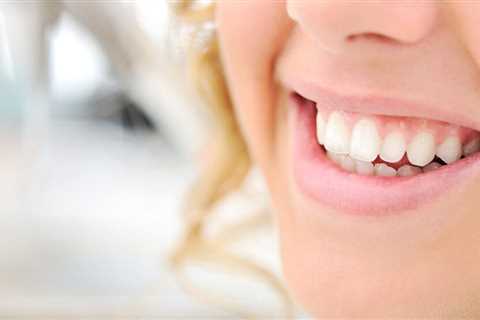 Natures Smile - A Natural Solution For periodontitis Problem - Natures Smile Reviews