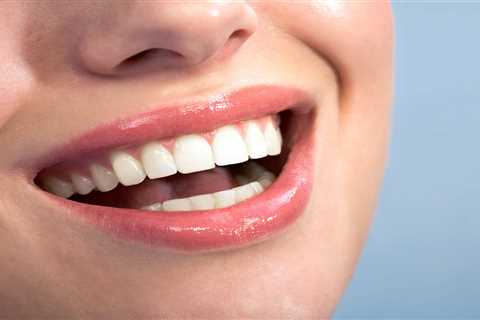 Natures smile - Best way to Stop Gum recession
