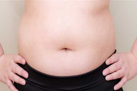 Liposuction Vs. Clinical Nutrition: A Big Fat Debate In Las Vegas