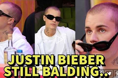 JUSTIN BIEBER IS STILL LOSING HAIR IN 2022.. **PROOF**