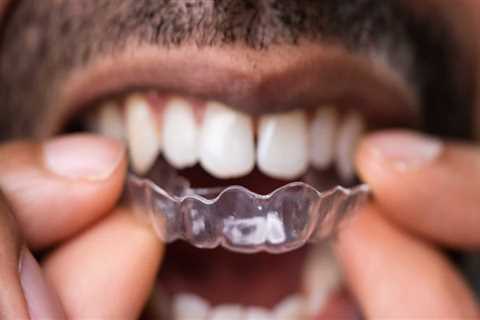 Are clear aligners bad for your teeth?
