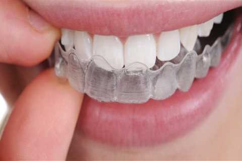 Are clear teeth aligners safe?
