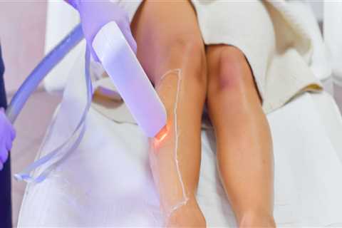 Is 3 laser hair removal treatments enough?