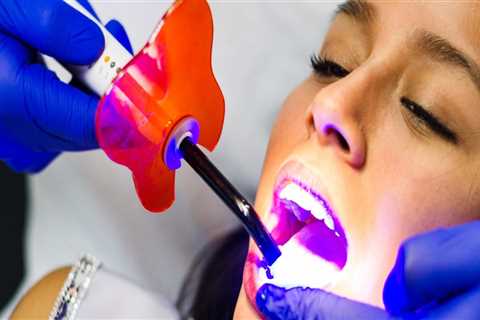 Laser Dentistry In London: What Are The Benefits And How Does It Work