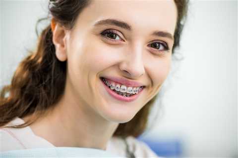 How Do I Know if I Need Braces? - The Daily Haze