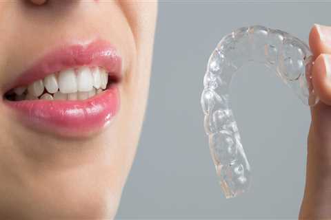 Where can i get clear aligners?