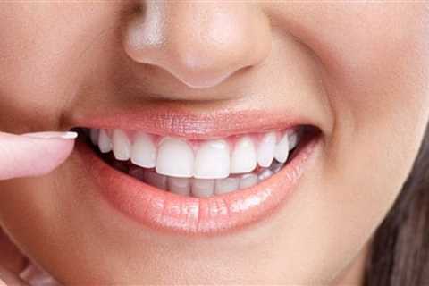 How Long Does Tooth Sensitivity Last After Whitening? - Dentists Atlanta