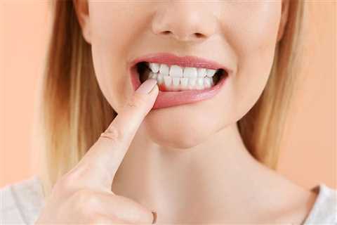 Treat Receding Gums At Home - Know About Natural Remedies - CASH CARE DOCTOR