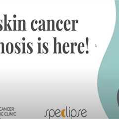 Revolutionizing Skin Cancer Diagnosis with Artificial Intelligence (AI)